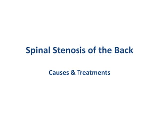 Spinal Stenosis of the Back Causes & Treatments 