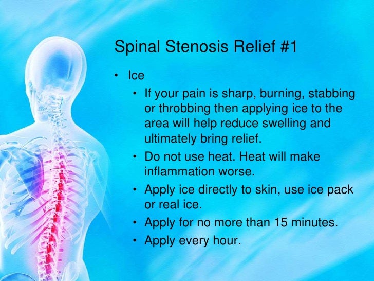 Spinal Stenosis Conservative Treatments
