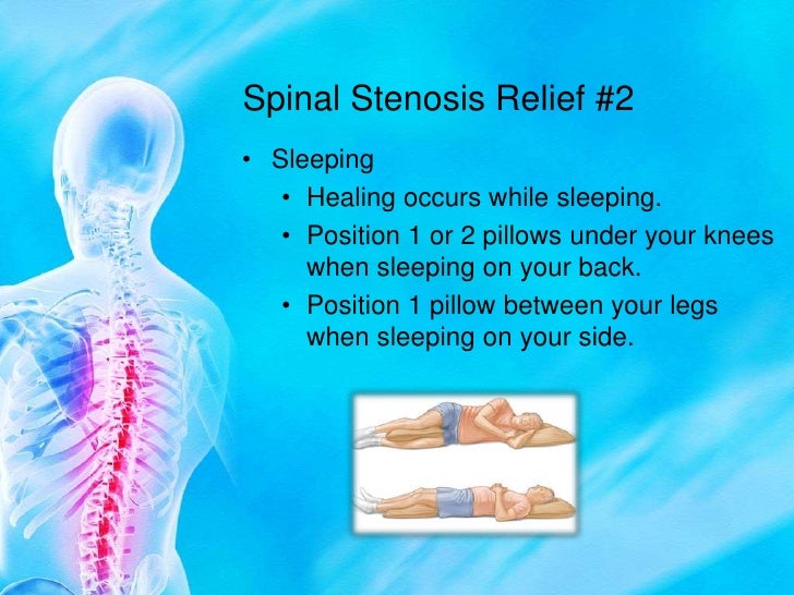 sleeping with cervical stenosis