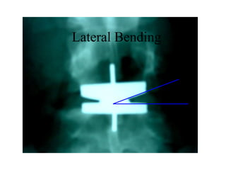+4°
Lateral Bending
 