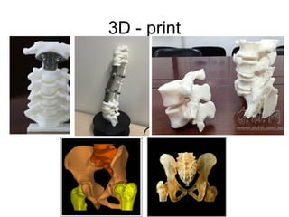 3D - print
 