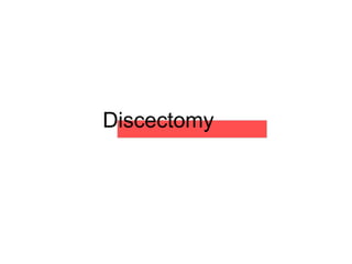 Discectomy
 