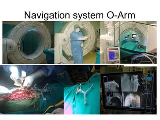 Navigation system O-Arm
 
