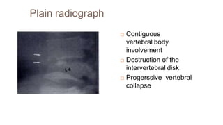 Plain radiograph
 Contiguous
vertebral body
involvement
 Destruction of the
intervertebral disk
 Progerssive vertebral
collapse
 