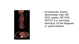  As tubercular lesions
demonstrate high 18F-
FDG uptake, 18F-FDG
PET/CT is a promising
technique for the diagnosis
of spinal infection
 