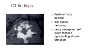 CT findings
 Vertebral body
collapse
 Disk space
narrowing
 Large paraspinal soft
tissue masses
representing abcess
formation
 