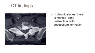 CT findings
 In chronic stages there
is marked bone
destruction with
sequestrum formation
 