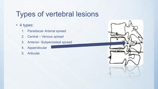 Types of vertebral lesions
• 4 types:
1. Paradiscal- Arterial spread
2. Central – Venous spread
3. Anterior- Subperiosteal spread
4. Appendicular
5. Articular
 