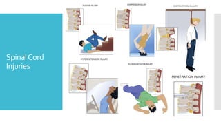 SpinalCord
Injuries
 