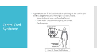 CentralCord
Syndrome
 Hyperextension of the cord results in pinching of the cord in pre-
existing degenerative narrowing od the spinal cord.
 Upper limbs and hands profoundly affected.
 Distal motor function in the legs usually spared.
 Fair Prognosis
 