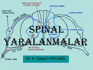 Spinal
yaralanmalar
   Dr A. Cüneyt HOCAGİL
 