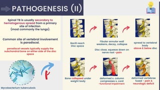Spinal tuberculosis (simplified) | PDF