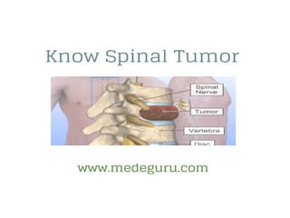 Spinal tumor