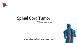 Spinal Cord Tumor
www.chennaibrainandspine.com
Wellness awaits you
 