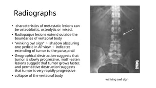 Comprehensive Overview of Spinal Tumors: Types, Diagnosis, and Clinical ...