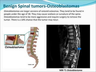 Osteoblastomas  are larger versions of osteoid osteomas. They tend to be found in people under the age of 30. They may cause scoliosis or curvature of the spine. Osteoblastomas tend to be more aggressive and require surgery to remove the tumor. There is a 10% chance that the tumor may recur.    MRI T1  Osteoblastoma Benign Spinal tumors-Osteoblastomas  