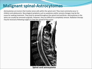 Spinal tumors lecture Slide 10