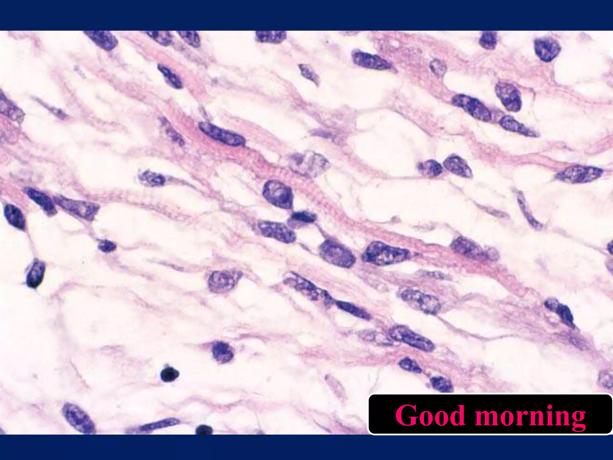 Spindle cell lesions of oral cavity part II PPT