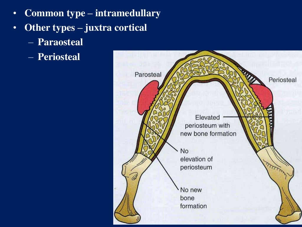 Spindle cell lesions of oral cavity part III
