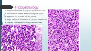 SUMMARY
 Spindle cell lesions of head & neck are diverse & diagnostically challenging
 High index of suspicion of spindl...