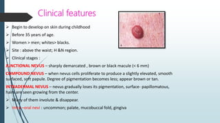 Histopathology
 Characteristic feature – benign, Unencapsulated proliferation of small, ovoid cells.(nevus
cells); lack t...