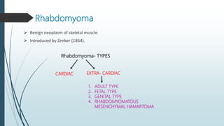 NATIONAL CANCER INSTITUTE
CLASSIFICATION OF
RHABDOMYOSARCOMA (1992)
Classification
 