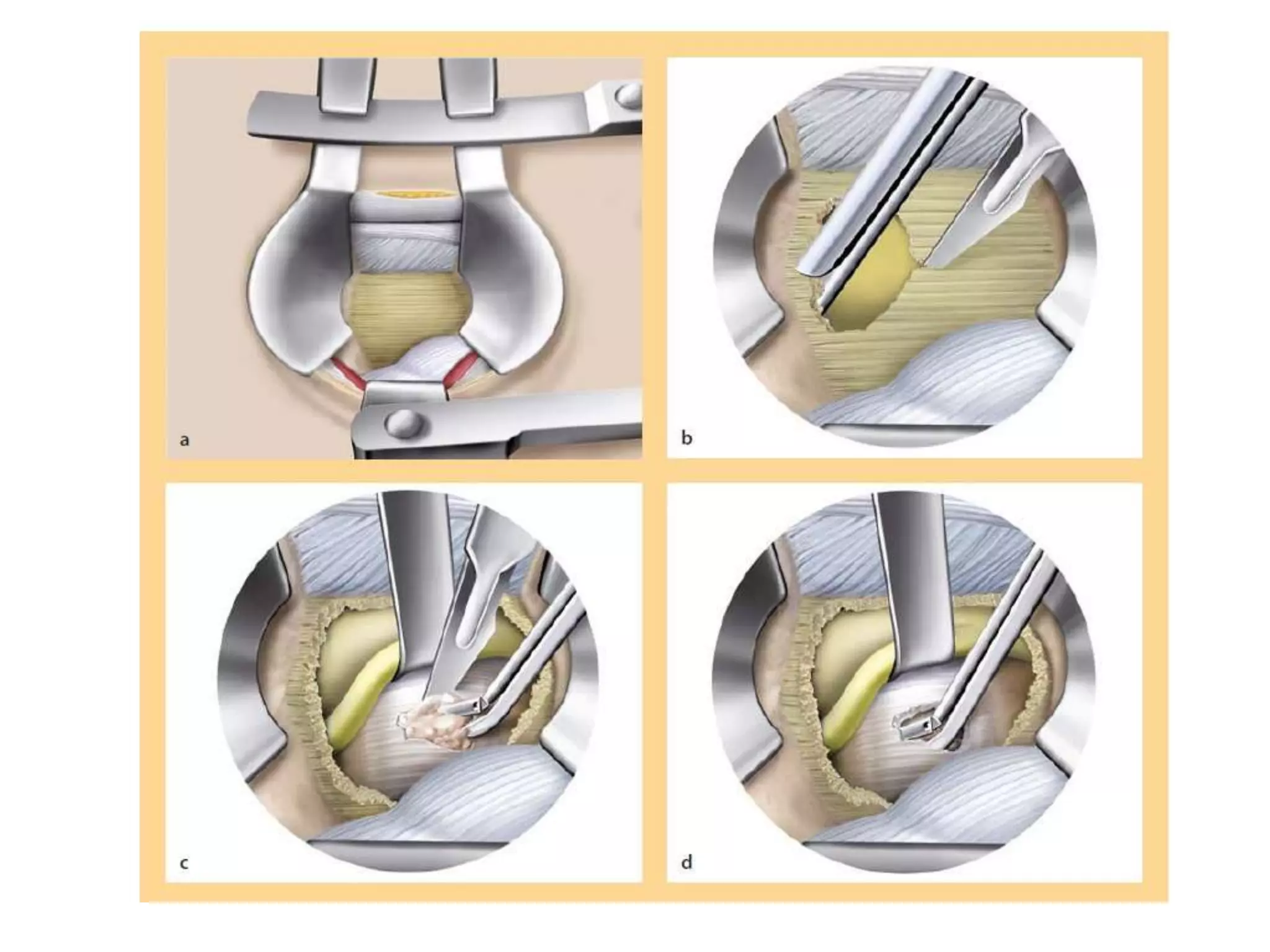 Surgery 6th year, Tutorial (Dr. Khalid Shokor Mahmood) | PPTX