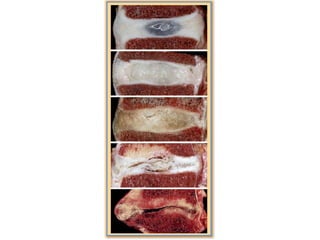 Surgery 6th year, Tutorial (Dr. Khalid Shokor Mahmood)