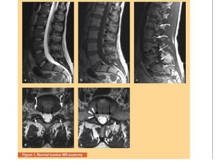 Surgery 6th year, Tutorial (Dr. Khalid Shokor Mahmood)