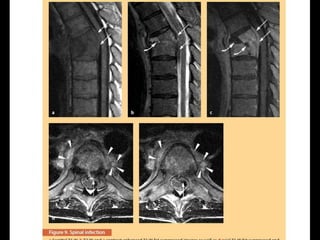 Surgery 6th year, Tutorial (Dr. Khalid Shokor Mahmood)