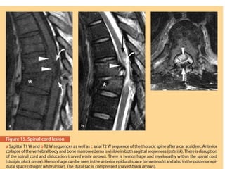 Surgery 6th year, Tutorial (Dr. Khalid Shokor Mahmood)