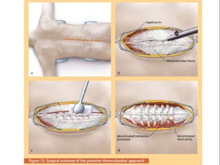Surgery 6th year, Tutorial (Dr. Khalid Shokor Mahmood)