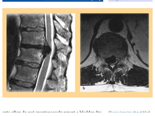Surgery 6th year, Tutorial (Dr. Khalid Shokor Mahmood)
