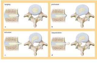 Surgery 6th year, Tutorial (Dr. Khalid Shokor Mahmood)