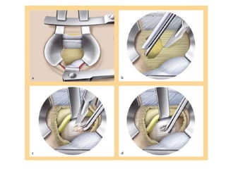 Surgery 6th year, Tutorial (Dr. Khalid Shokor Mahmood)