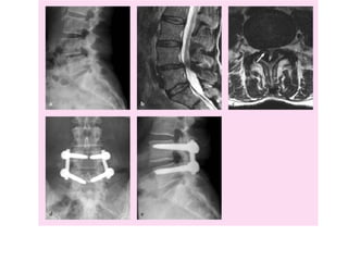 Surgery 6th year, Tutorial (Dr. Khalid Shokor Mahmood)