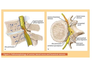 Surgery 6th year, Tutorial (Dr. Khalid Shokor Mahmood)