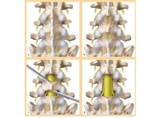 Surgery 6th year, Tutorial (Dr. Khalid Shokor Mahmood)