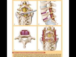Surgery 6th year, Tutorial (Dr. Khalid Shokor Mahmood)