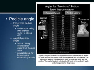 • Pedicle angle
– transverse pedicle
angle
• varies from 10deg
(mid thoracic
spine) to 30deg
(L5)
– sagittal pedicle
angle
• About 15 deg
cephalad for
majority of thoracic
spine
• neutral (0deg) for
lumbar spine
except L5 (caudal)
 