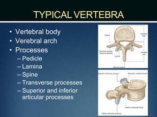 TYPICALVERTEBRA
• Vertebral body
• Verebral arch
• Processes
– Pedicle
– Lamina
– Spine
– Transverse processes
– Superior and inferior
articular processes
 