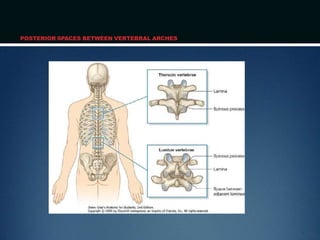 POSTERIOR SPACES BETWEEN VERTEBRAL ARCHES
 