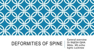 DEFORMITIES OF SPINE
General overview
Dr RAJESH OJHA
Mbbs MS ortho
kgmc Lucknow
 