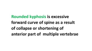 Rounded kyphosis is excessive
forward curve of spine as a result
of collapse or shortening of
anterior part of multiple vertebrae
 