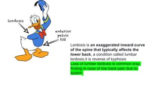 Lordosis is an exaggerated inward curve
of the spine that typically affects the
lower back, a condition called lumbar
lordosis,it is reverse of kyphosis
Loss of lumber lordosis is common xray
finding in case of low back pain due to
spasm
 