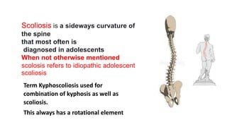 Scoliosis is a sideways curvature of
the spine
that most often is
diagnosed in adolescents
When not otherwise mentioned
scolosis refers to idiopathic adolescent
scoliosis
Term Kyphoscoliosis used for
combination of kyphosis as well as
scoliosis.
This always has a rotational element
 