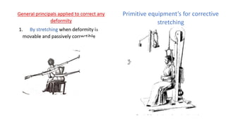 Primitive equipment’s for corrective
stretching
 