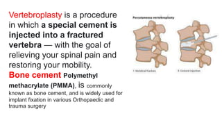 Vertebroplasty is a procedure
in which a special cement is
injected into a fractured
vertebra — with the goal of
relieving your spinal pain and
restoring your mobility.
Bone cement Polymethyl
methacrylate (PMMA), is commonly
known as bone cement, and is widely used for
implant fixation in various Orthopaedic and
trauma surgery
 
