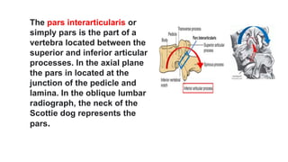 The pars interarticularis or
simply pars is the part of a
vertebra located between the
superior and inferior articular
processes. In the axial plane
the pars in located at the
junction of the pedicle and
lamina. In the oblique lumbar
radiograph, the neck of the
Scottie dog represents the
pars.
 