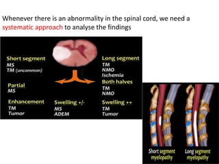Whenever there is an abnormality in the spinal cord, we need a
systematic approach to analyse the findings
 